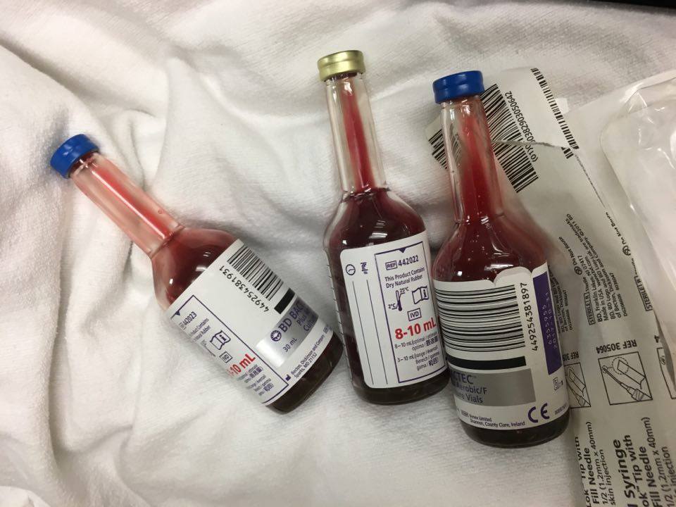 fever blood